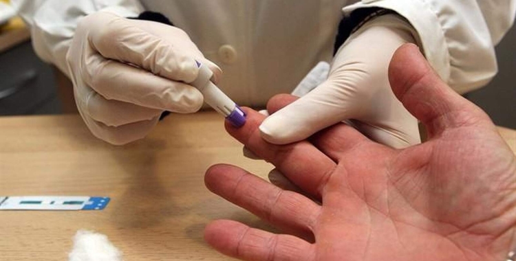 Una persona es fa la prova del VIH 