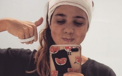 Corró, després de la segona operació | Cedida