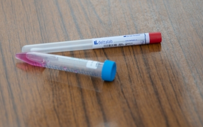 Imatge d'una prova de laboratori de Covid-19 | Roger Benet (Arxiu)