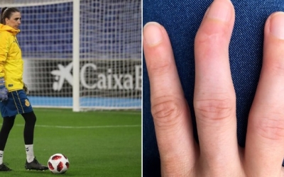 Aquest és l'estat de la mà de Pons | Twitter