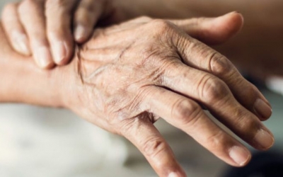 Un estudi de la UAB avala que el pasdoble millora la vida dels malalts de Parkinson