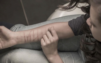 Imatge d'autolesions/ Cedida