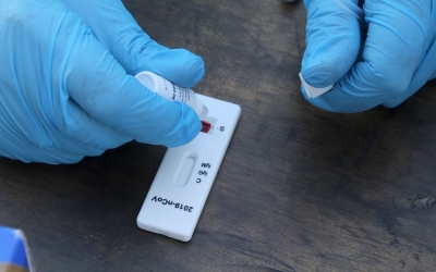 Imatge d'un test d'antígens/ ACN