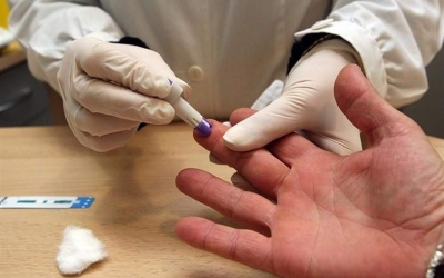 Una persona es fa la prova del VIH 